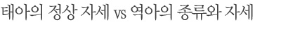 태아의 정상 자세vs 역아의 종류와 자세